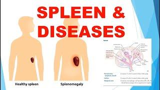 USMLE Step 1 Immunology SPLEEN & DISEASES with 20 USMLE Step 1 questions.