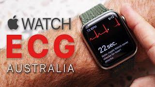 Apple Watch ECG Australia Update