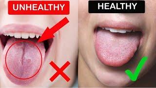 What Your Tongue Says About Your Health  What Your Tongue Reveal About Your Health