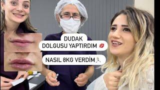 DUDAK DOLGUSU YAPTIRDIMÖNCESİ  SONRASIİLK 15 GÜNNASIL ZAYIFLADIM ‍️VLOG🪞