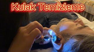 Çin’de Kulak Temizliği Nasıl Yapılır? Çin Kültürü Kulak Temizleme. Görülmesi Yapılması Gerekenler