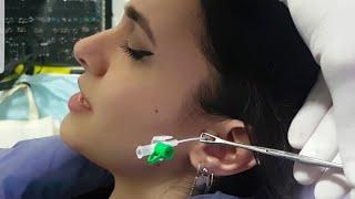 Taşlı Tragus Piercing Delimi