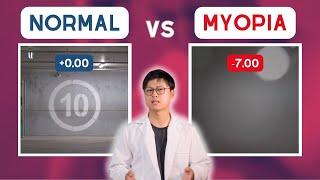 MYOPIA vs normal vision POV