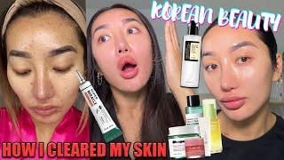 HOW I TRANSFORMED MY SKIN WITH KOREAN BEAUTY SKINCARE UPDATED SKINCARE ROUTINE  #kbeauty