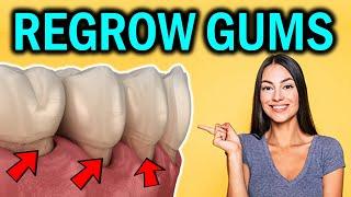 How to Regrow Receding Gums Naturally Reverse Gum Recession without Surgery