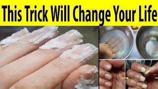 Baking soda  Uses of baking soda  baking soda use  baking soda nails  Med Guide