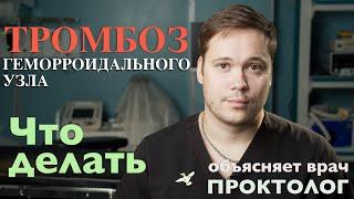 ТРОМБОЗ ГЕМОРРОИДАЛЬНОГО УЗЛА - Что делать как лечить - объясняет врач Проктолог.