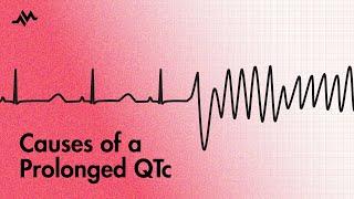 Causes of a prolonged QT interval