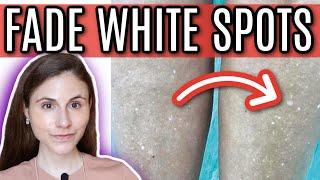 How to FADE WHITE SPOTS from SUN DAMAGE  Dr Dray