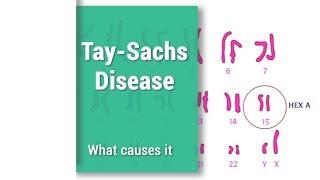 Tay-Sachs Disease  THD  Hex A  Hexosaminidase A