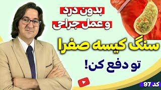 پیشگیری و درمان مجرب سنگ کیسه صفرا و کبد چرب در 3 هفته بدون درد و جراحی  دکتر جاوید