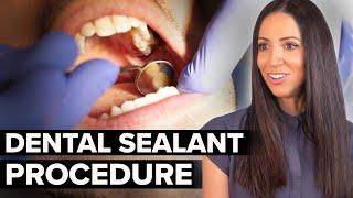 Dental Sealants at the Dentist