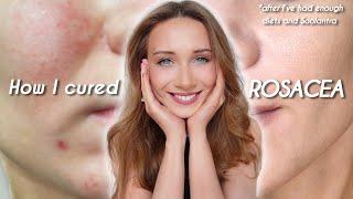 MY ROSACEA STORY Unbelievable Healing After 10 Years - My Most Emotional Video