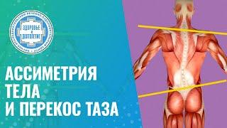 ⁉️ Ассиметрия тела и перекос таза