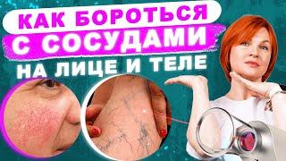 Удаление сосудов на лице и теле. Делать или нет?