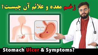 زخم معده چیست و علایم زخم معده چیست  داکترستان  What is Stomach Ulcer Symptoms of Stomach Ulcer