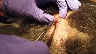 Cuterebra Removal