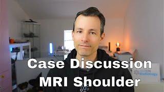 Live MRI Case Discussion - Case 4 Shoulder