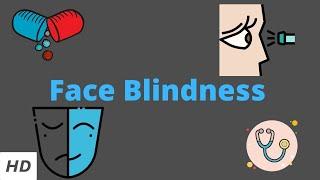 Face Blindness Causes Signs and Symptoms DIagnosis and Treatment.