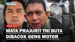 KETERLALUAN Mata Prajurit TNI Raider 100 Buta Usai Diserang Geng Motor Walikota Medan Irit Bicara