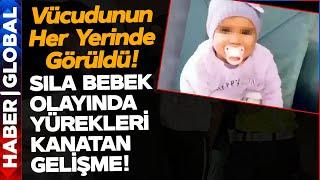 Sıla Bebek Olayında Kan Donduran Gelişme Vücudunun Her Yerinde Görüldü