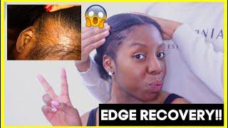 GROW EDGES BACK AFTER RELAXER BURN  TRANSITIONING HAIR JOURNEY 2019