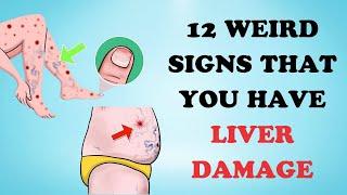 Summing Up All Liver Disease Symptoms How to Identify and Safeguard Your Liver Health