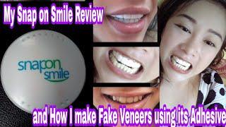 Snap On Smile Review  How Do I Make Fake Veneers Using Its Adhesive