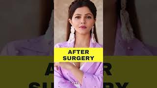 Rubina Dilaik Before And After Plastic Surgery  Entertainment News  Her Zindagi