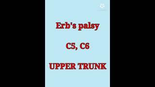 erbs palsy & klumpkes palsy trick