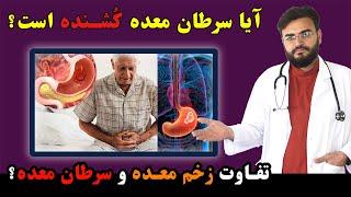 آیا سرطان معده کشنده است  Does Stomach Cancer Kills Stomach pain Ulcer and cancer difference