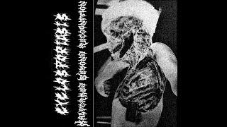 CYCLOSPORIASIS Gorenoise  NY  Malformed Beyond Recognition album preview