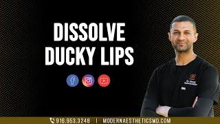 Get your Ducky Lips Dissolved - No More Ducky Lips - Dr. Anwar MD - Modern Aesthetics