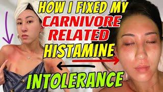 How to fix histamine intolerance  Carnivore Foods to AVOID high in histamines  autoimmune tips