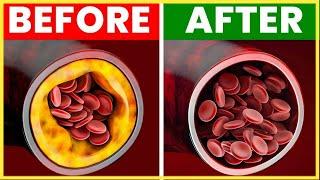 3 Best Nutrients to Remove Plaque from Arteries Clogged Arteries