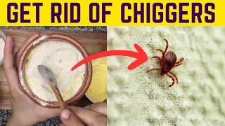 Effortlessly Remove Chiggers from Your Yard & Prevent Their Bites