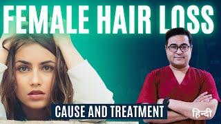 Female Hair Loss  The Most Detailed Video Ever  Dr. Vikram #femalehairloss