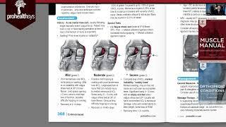 Medial Collateral Ligament MCL Sprain Dr Vizniak