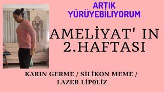 AMELİYAT IN 2. HAFTASI  KARIN GERME  SİLİKON MEME  LAZER LİPOLİZ