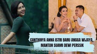 Potret Cantik Nurul Kamariah Alias Anna Istri Baru Angga Wijaya Mantan Suami Dewi Perssik