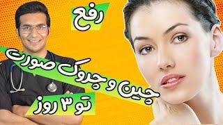 Treatment of facial wrinkles  درمان سریع چین و چروک صورت