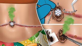 ASMR animation Removing Huge Navel Stone & Clean Navel Piercings  WOW Brain Satisfyingvideo