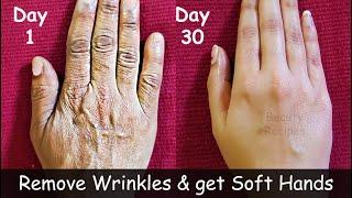 Remove Wrinkles from Hands  Make your Hands Look 10 Years Younger - Get Baby Soft Hands - Dry Hands