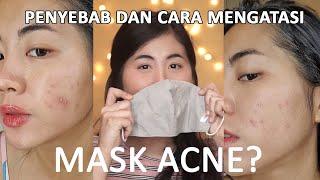 MASKNE  jerawat akibat masker. Gak perlu produk khusus pahami ini aja