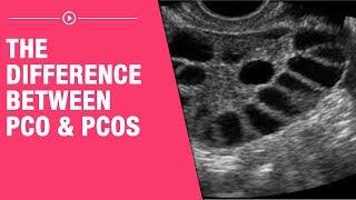 The Difference between PCO & PCOS