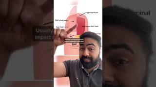 Dr Karan - What Are White Spots on Finger Nails?