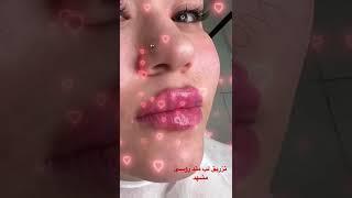 ژل لب روسی در مشهد