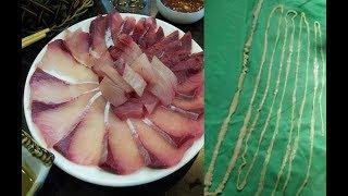 Girl has 8ft 6in long tapeworm removed from eating sashimi