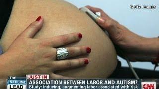 New study links induced labor to autism