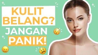 AMPUH 4 Cara Meratakan Warna Kulit Badan yang Belang